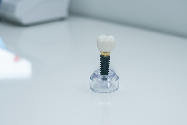 Implant Crowns: The Key To Restoring Missing Teeth